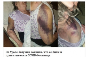 85 летнюю жительницу Кушвы выписали из больницы со сломанной рукой и страшными синяками по всему телу
